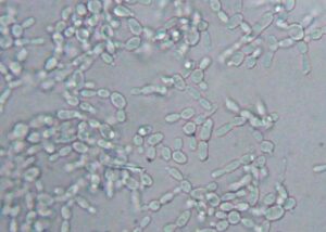 candida yeast